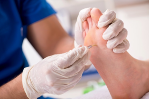 Understanding And Treating Foot Corns: A Comprehensive Guide