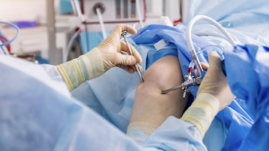 How to Choose Among the Best Arthroscopy Hospitals in India