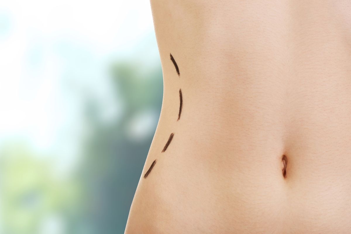non surgical butt lift