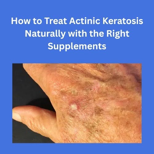 How to Treat Actinic Keratosis Naturally with the Right Supplements